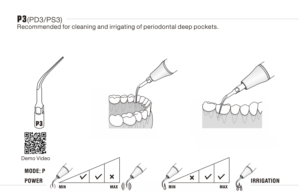Puntas para Ultrasonido "P" Sirona Woodpecker