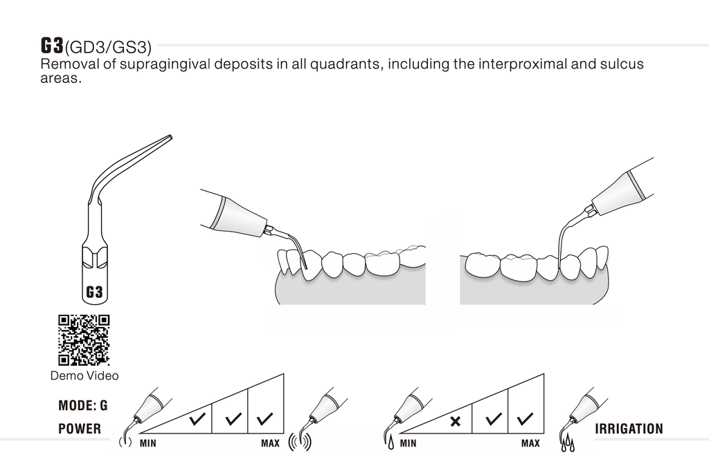 Puntas para Ultrasonido "G" Sirona Woodpecker