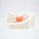 Modelo estudio y práctica Injerto óseo Machtig