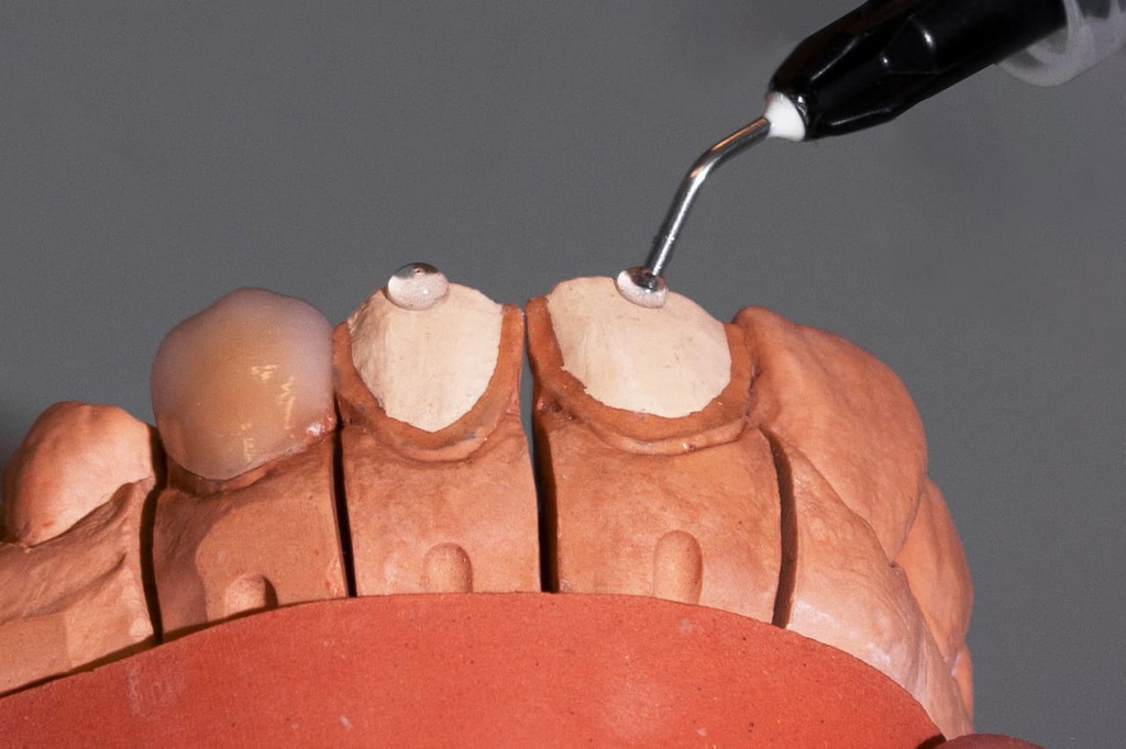 Gel Fijador adhesivo Fixing gel Yeti dental