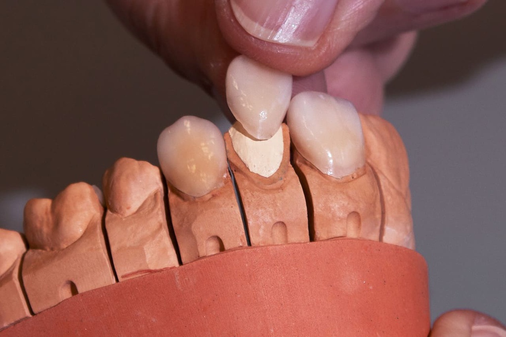 Gel Fijador adhesivo Fixing gel Yeti dental