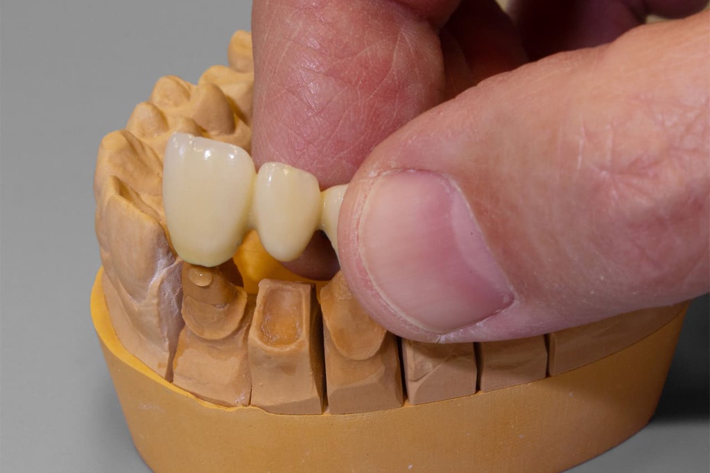 Gel Fijador adhesivo Fixing gel Yeti dental