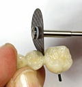 Disco Corte para Cerámica/Zirconio Magic Disc Yeti dental
