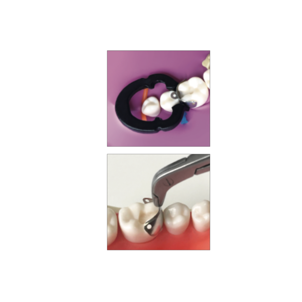 Set de 50 Bandas Matriz preformada acero Matrix M4 1.0 ZT Dental