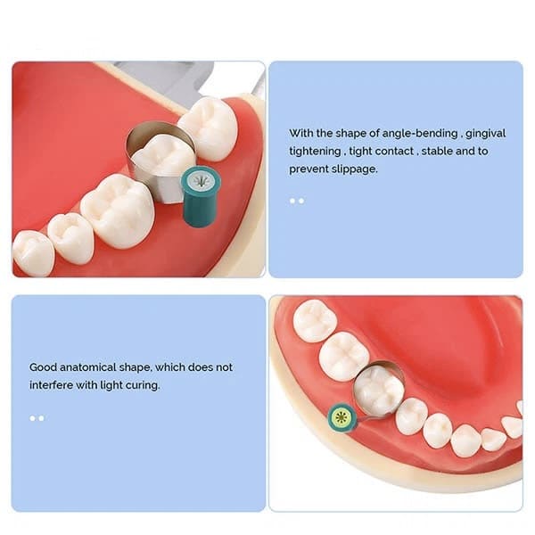 Set de 50 Bandas Matriz acero con ajuste M6 tipo Kerr 0,038 mm ZT Dental