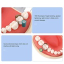 Set de 50 Bandas Matriz acero con retenedor M6 tipo Kerr 0,03 mm ZT Dental