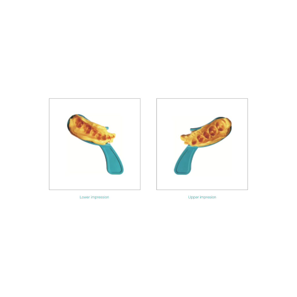 Set de 36 Cubetas para Triple impresión Autoclavables ZT dental