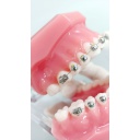 Modelo estudio maxilares Ortodoncia con Bracket autoligado esféricos M7003 Machtig