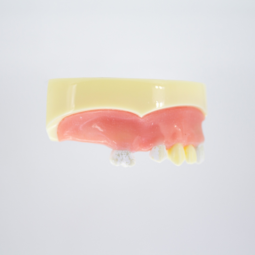 Modelo estudio y práctica Implantología con encía Max. Superior CBCT Machtig