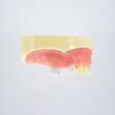 Modelo estudio y práctica Implantología con encía Max. Superior CBCT Machtig