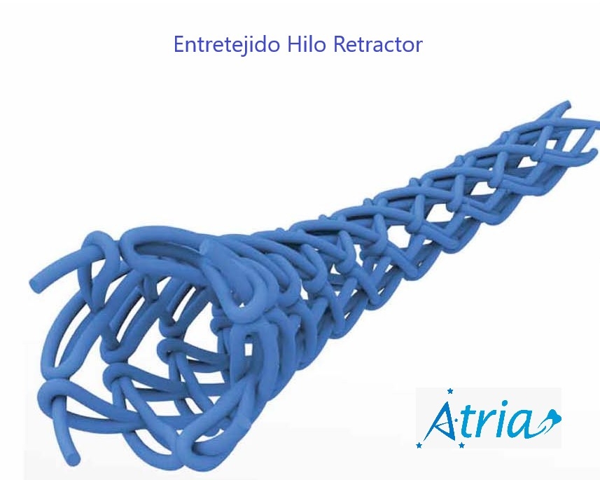 Hilos Retractores con Sulfato Atria
