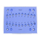 1 Caso Brackets Autoligado esféricos Machtig