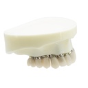 Modelo estudio y práctica Implantología con 4 tornillos Max. Superior M6023 Machtig