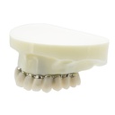 Modelo estudio y práctica Implantología con 4 tornillos Max. Superior M6023 Machtig