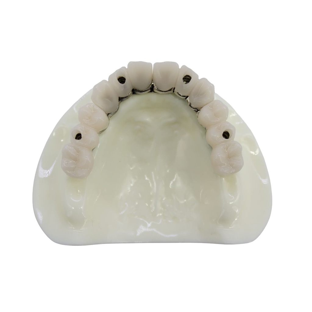 Modelo estudio y práctica Rehabilitación con 4 tornillos Max. Superior M6023 Machtig