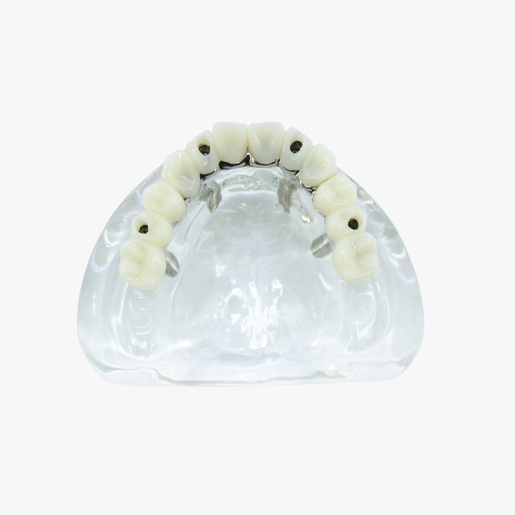 Modelo estudio y práctica Rehabilitación con 4 tornillos Max. Superior M6001-1 Machtig