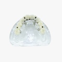 Modelo estudio y práctica Rehabilitación con 4 tornillos Max. Superior M6001-1 Machtig