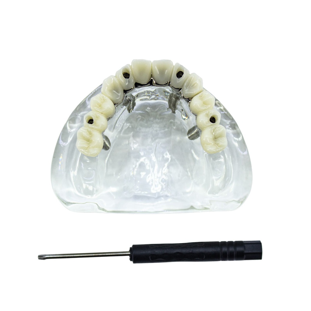 Modelo estudio y práctica Rehabilitación con 4 tornillos Max. Superior M6001-1 Machtig