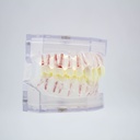 Modelo estudio maxilares Endodoncia con canales radiculares Machtig