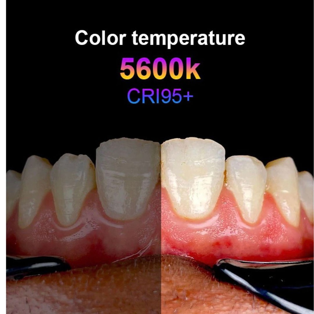 Set de Flash dual para Fotografía dental Ehros