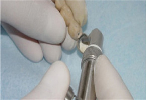 Microarenadora dual Machtig