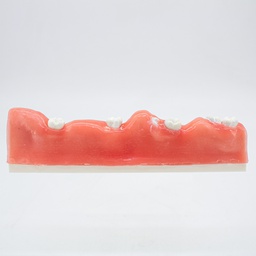 [DIA4203] Modelo estudio Extracción de dientes impactados CBCT Machtig